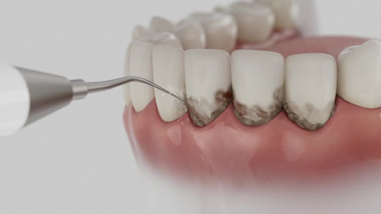 Trusted Dental Crowns And Bridges service in Magnolia, MS - Dentist Open Now